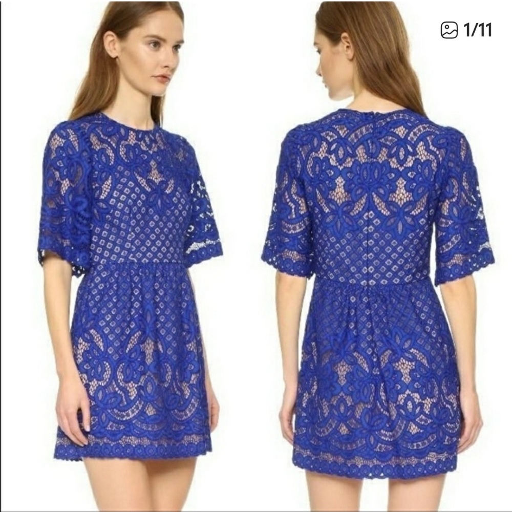 Elegant Blue Lace Dress